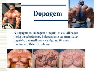 Dopagem

A dopagem ou dopagem bioquímica é a utilização
ilícita de substâncias, independente da quantidade
ingerida, que melhoram de alguma forma o
rendimento físico de atletas.
 