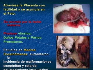 Atraviesa la Placenta con
facilidad y se acumula en
el Feto.

Se excreta por la leche
  materna.

Produce Abortos,
Daños Fetales y Partos
Prematuros.

Estudios en Madres
Cocainómanas : aumentaron
  la
incidencia de malformaciones
congénitas y retardo
 