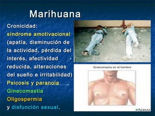 Marihuana
Cronicidad:
síndrome amotivacional
(apatía, disminución de
la actividad, pérdida del
interés, afectividad
reducida, alteraciones
del sueño e irritabilidad)
Psicosis y paranoia
Ginecomastia
Oligospermia
y disfunción sexual .
 