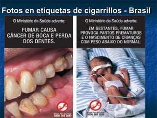 Fotos en etiquetas de cigarrillos - Brasil
 