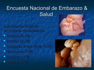 Encuesta Nacional de Embarazo &
              Salud

Autoinforme Uso/Año
en mujeres embarazadas
 Tabaco 20,4%

 Alcohol 18,8%

 Cualquier droga ilícita 5,5%

 Marihuana 2,9%

 Cocaína 1,1%

 Heroína 0,1%
 