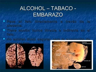 ALCOHOL – TABACO -
               EMBARAZO
   Pasa al feto directamente a través de         la
    placenta.
   Tiene acción toxica directa e indirecta en    el
    feto.
   No existen dosis seguras para la exposición   de
    etanol al feto.
 