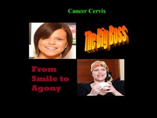 Cancer Cervix




From
Smile to
Agony
 