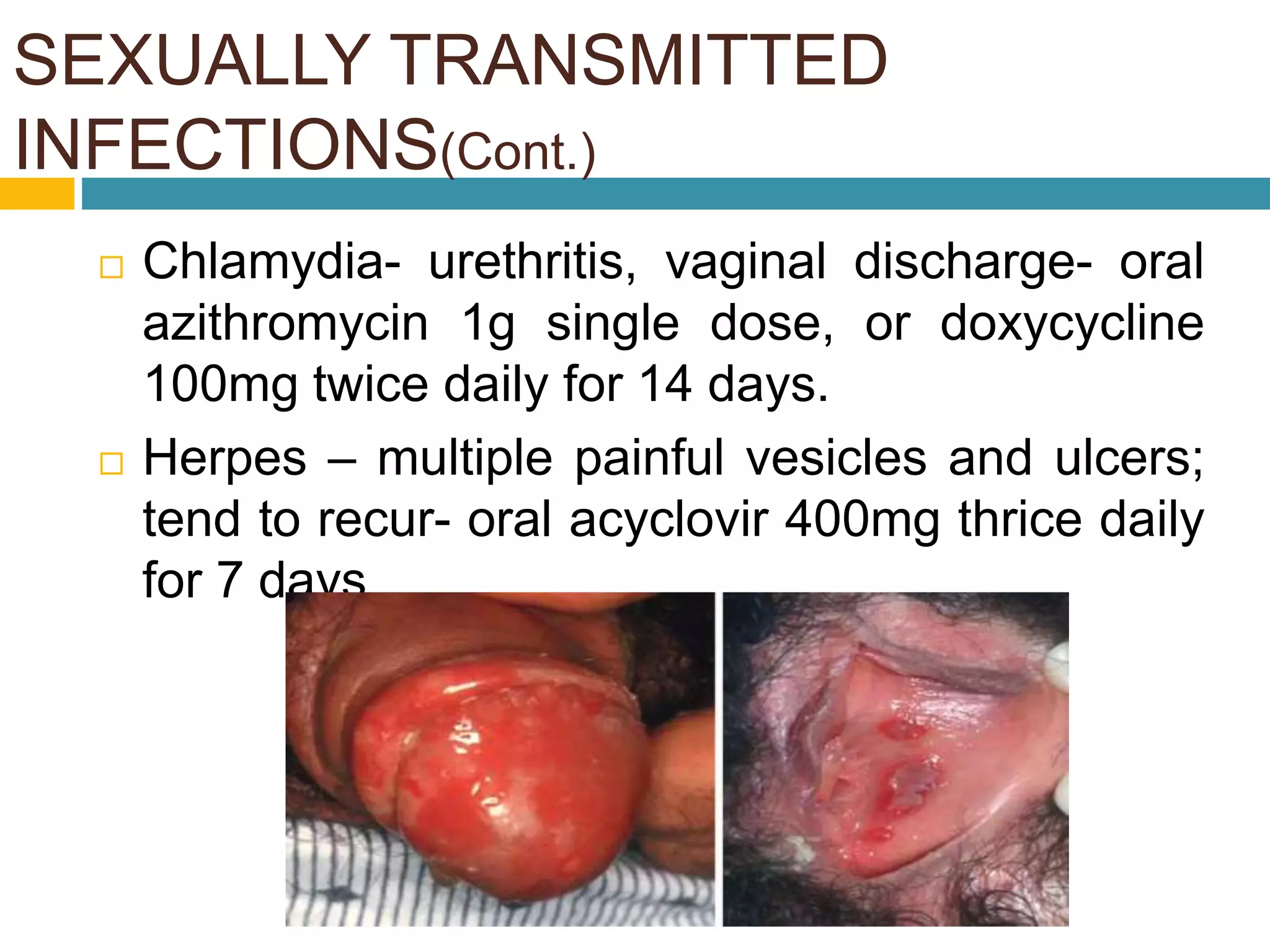 SEXUALLY TRANSMITTED
INFECTIONS(Cont.)
GHAI 8TH EDITION PG 63-69
 Chlamydia- urethritis, vaginal discharge- oral
azithromycin 1g single dose, or doxycycline
100mg twice daily for 14 days.
 Herpes – multiple painful vesicles and ulcers;
tend to recur- oral acyclovir 400mg thrice daily
for 7 days
 