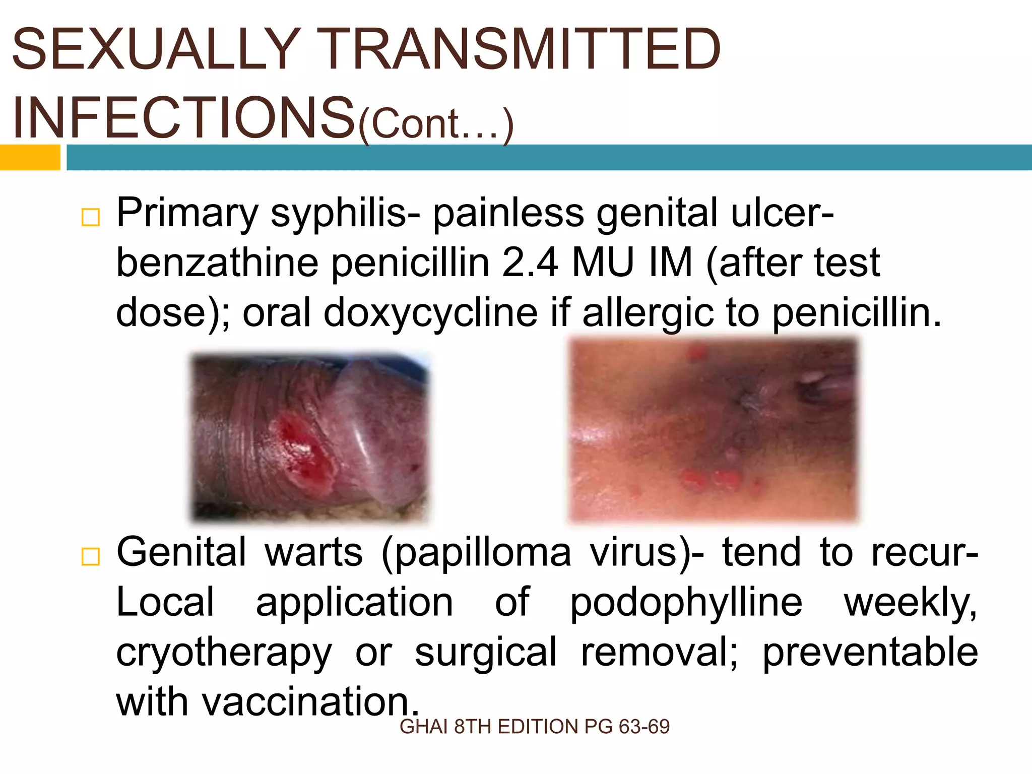 GHAI 8TH EDITION PG 63-69
 Primary syphilis- painless genital ulcer-
benzathine penicillin 2.4 MU IM (after test
dose); oral doxycycline if allergic to penicillin.
 Genital warts (papilloma virus)- tend to recur-
Local application of podophylline weekly,
cryotherapy or surgical removal; preventable
with vaccination.
SEXUALLY TRANSMITTED
INFECTIONS(Cont…)
 