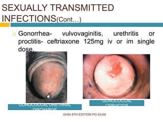 GHAI 8TH EDITION PG 63-69
 Gonorrhea- vulvovaginitis, urethritis or
proctitis- ceftriaxone 125mg iv or im single
dose.
SEXUALLY TRANSMITTED
INFECTIONS(Cont…)
GONOCOCCAL URETHRAL
DISCHARGE
GONOCOCCAL
CERVICITIS
 