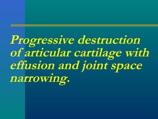 Progressive destruction
of articular cartilage with
effusion and joint space
narrowing.
 