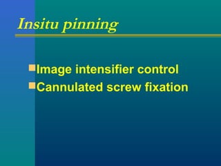 Insitu pinning
Image intensifier control
Cannulated screw fixation
 