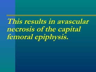 This results in avascular
necrosis of the capital
femoral epiphysis.
 