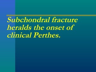 Subchondral fracture
heralds the onset of
clinical Perthes.
 