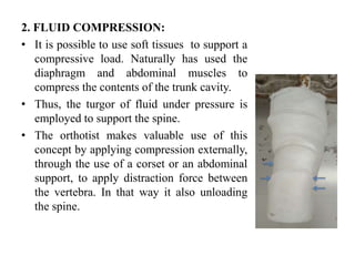 ADOLESCENT IDIOPATHIC SCOLIOSIS AND ITS ORTHOTICS MANAGEMENT.pptx