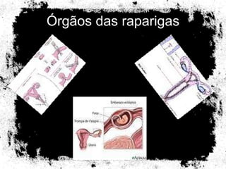 Órgãos das raparigas 