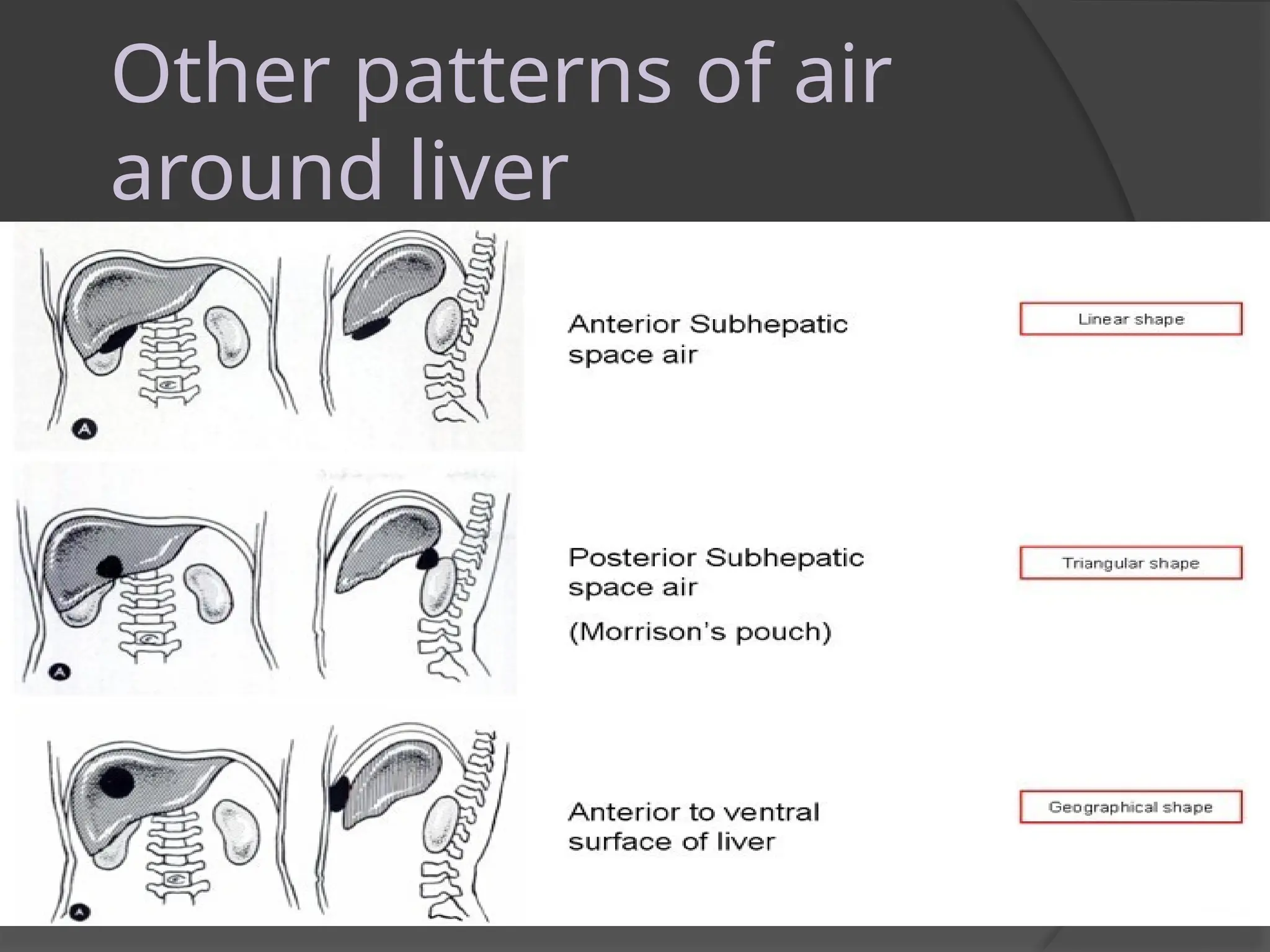 ADOMINAL IMAGING 1.pptx presentation for master | PPTX