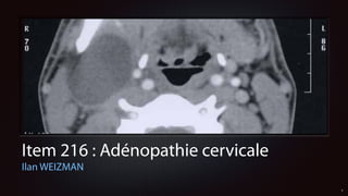 Item 216 : Adénopathie cervicale
Ilan WEIZMAN
1
 