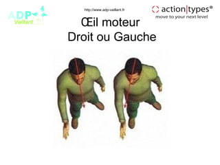 http://www.adp-vaillant.fr



  Œil moteur
Droit ou Gauche
 