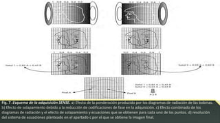 Fig. 7. Esquema de la adquisición SENSE. a) Efecto de la ponderación producido por los diagramas de radiación de las bobinas.
b) Efecto de solapamiento debido a la reducción de codificaciones de fase en la adquisición. c) Efecto combinado de los
diagramas de radiación y el efecto de solapamiento y ecuaciones que se obtienen para cada uno de los puntos. d) resolución
del sistema de ecuaciones planteado en el apartado c por el que se obtiene la imagen final.
 