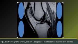 Fig 2. Cuatro receptores totales, dos ant. , dos post. Se puede realizar la adquisición paralela
 
