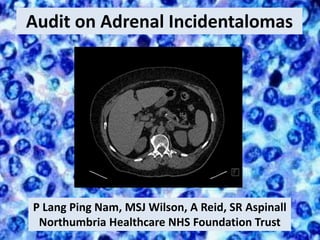 Audit on Adrenal Incidentalomas
P Lang Ping Nam, MSJ Wilson, A Reid, SR Aspinall
Northumbria Healthcare NHS Foundation Trust
 