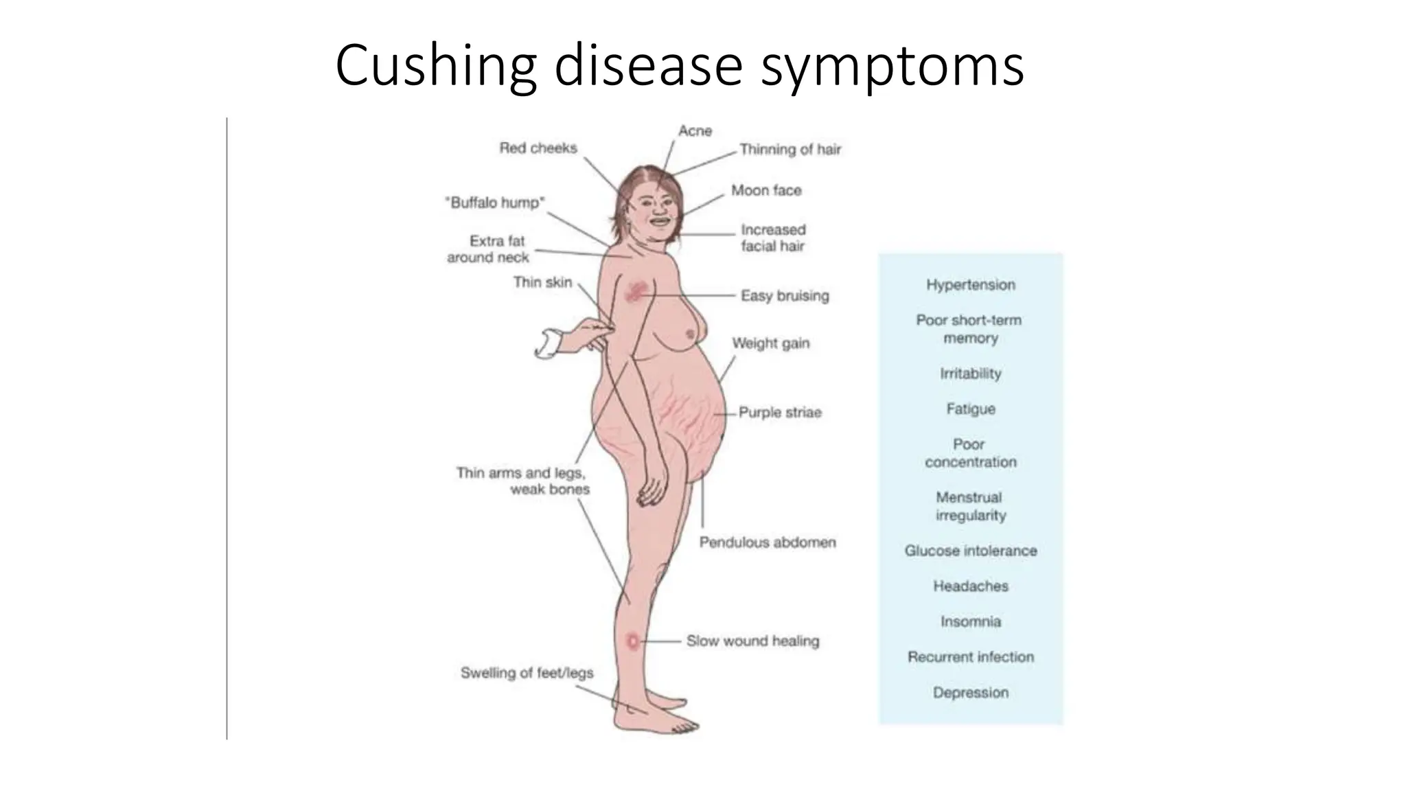 Cushing disease symptoms
 