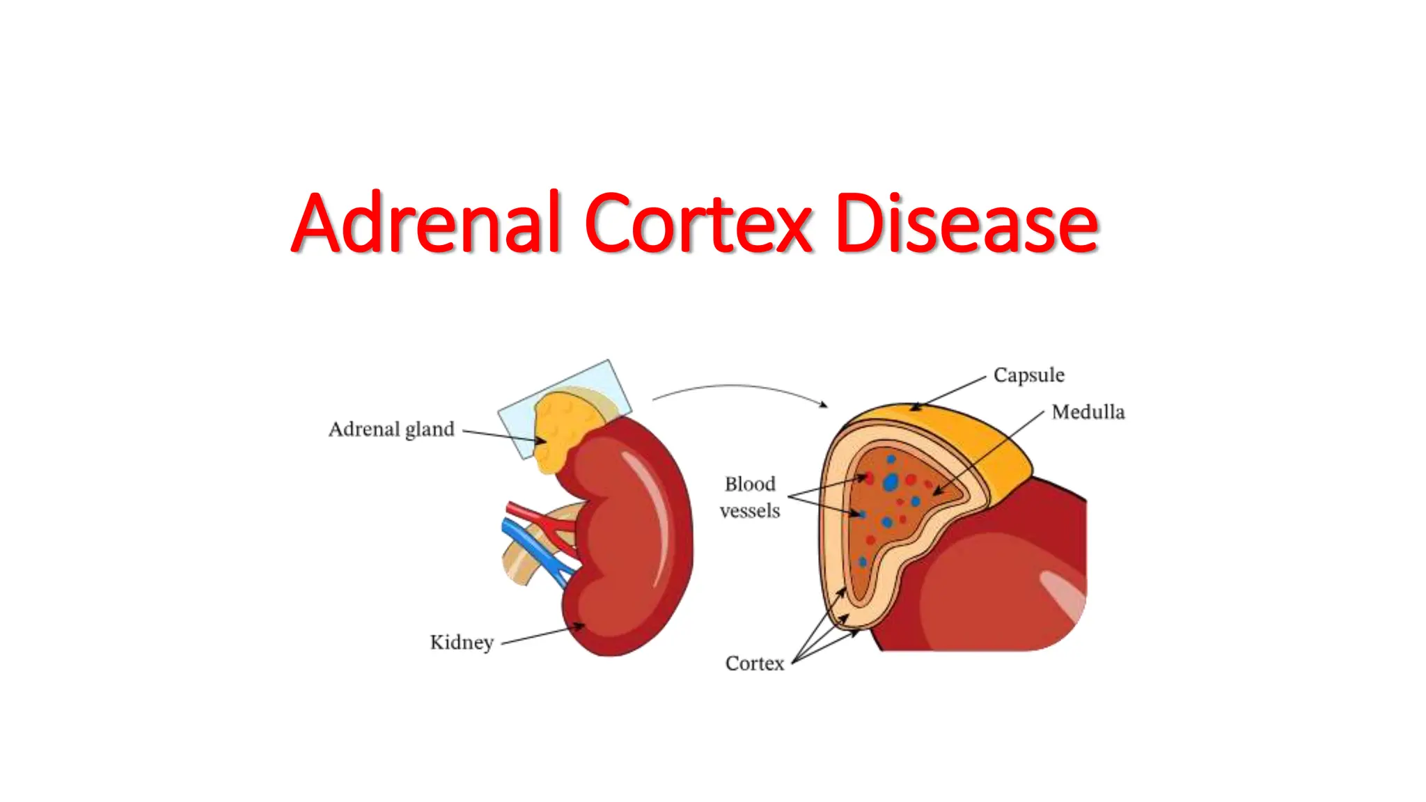 Adrenal Cortex Disease
 