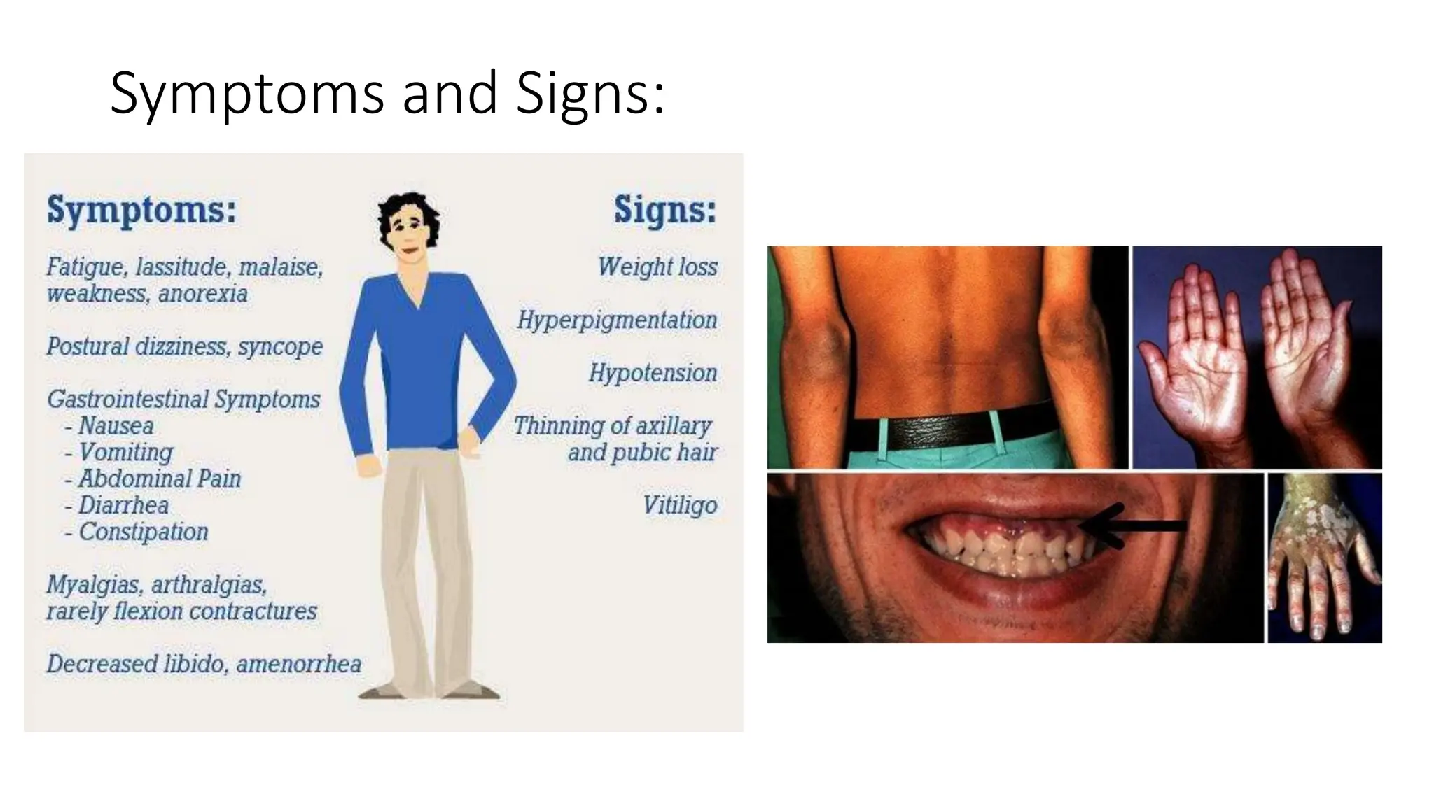 Symptoms and Signs:
 