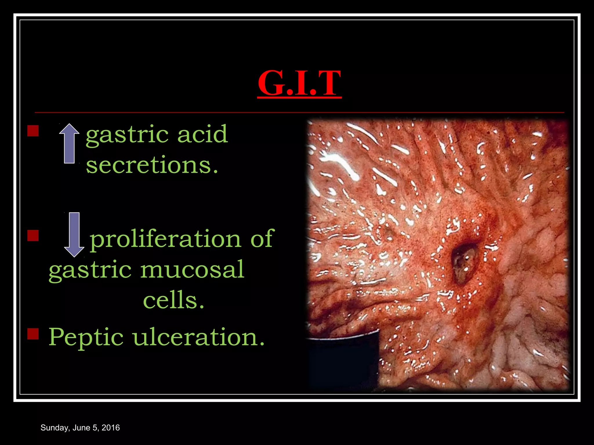 G.I.T
 gastric acid
secretions.
 proliferation of
gastric mucosal
cells.
 Peptic ulceration.
Sunday, June 5, 2016
 