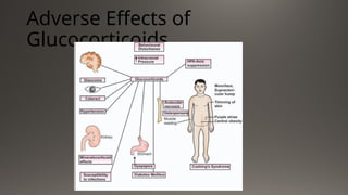 Adverse Effects of
Glucocorticoids
 