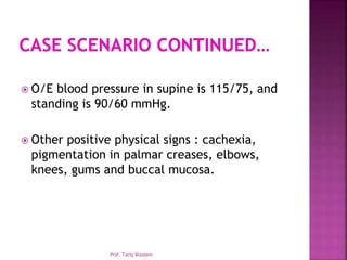  O/E blood pressure in supine is 115/75, and
standing is 90/60 mmHg.
 Other positive physical signs : cachexia,
pigmentation in palmar creases, elbows,
knees, gums and buccal mucosa.
Prof. Tariq Waseem
 
