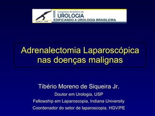 Adrenalectomia Laparoscópica nas doenças malignas Tibério Moreno de Siqueira Jr. Doutor em Urologia, USP Fellowship em Laparoscopia, Indiana University Coordenador do setor de laparoscopia, HGV/PE 