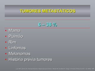 TUMORES METASTÁTICOS 6 – 38 % Mama Pulmão Rim Linfomas Melanomas História prévia tumores Lucon AM, Latronico AC. Doenças benignas e malignas das supra-renais. In: Barata HS, Carvalhal GF. Urologia - Princípios e Prática. Pp. 581-7, ed. ArtMed. 1999 