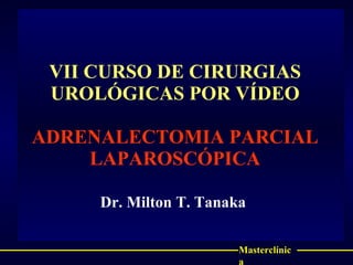 VII CURSO DE CIRURGIAS UROLÓGICAS POR VÍDEO ADRENALECTOMIA PARCIAL LAPAROSCÓPICA Dr. Milton T. Tanaka  