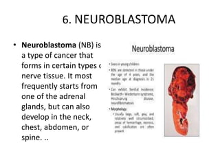 6. NEUROBLASTOMA
• Neuroblastoma (NB) is
a type of cancer that
forms in certain types of
nerve tissue. It most
frequently starts from
one of the adrenal
glands, but can also
develop in the neck,
chest, abdomen, or
spine. ..
 