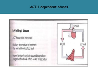 ACTH dependent causes
 