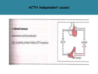 ACTH independent causes
 