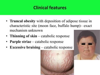 Clinical features
• Truncal obesity with deposition of adipose tissue in
characteristic site (moon face, buffalo hump)– exact
mechanism unknown
• Thinning of skin – catabolic response
• Purple striae – catabolic response
• Excessive bruising – catabolic response
 