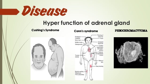 hyper adrenaline syndrome hyper adrenaline syndrome