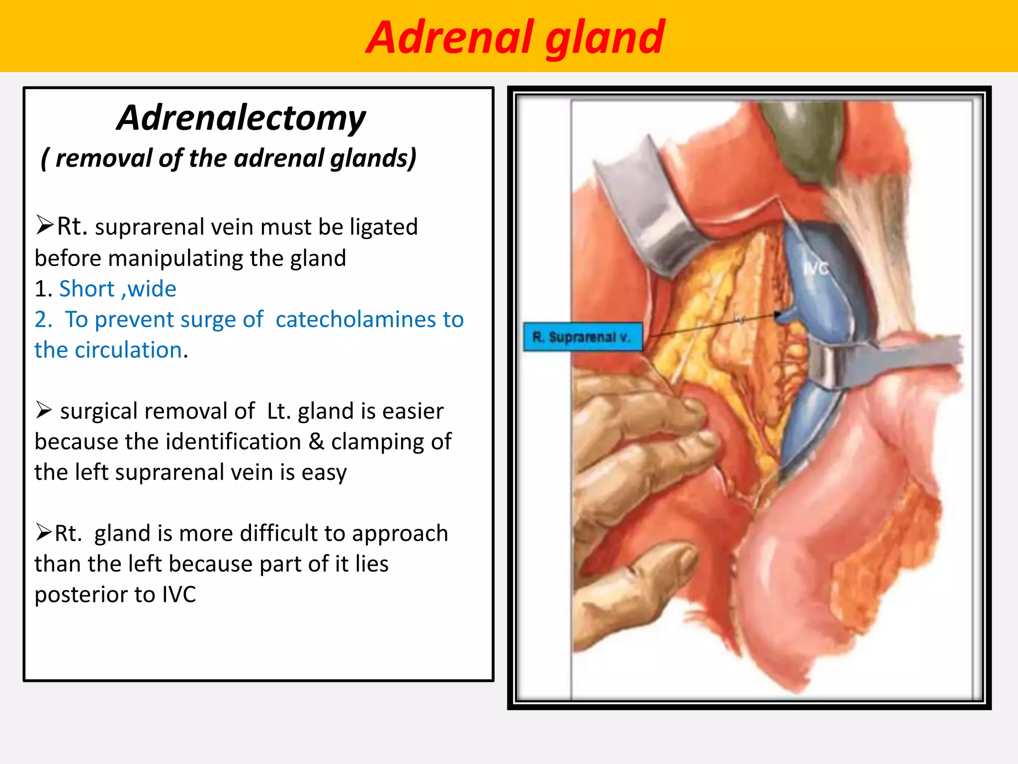 Adrenal gland
Adrenalectomy
( removal of the adrenal glands)
Rt. suprarenal vein must be ligated
before manipulating the gland
1. Short ,wide
2. To prevent surge of catecholamines to
the circulation.
 surgical removal of Lt. gland is easier
because the identification & clamping of
the left suprarenal vein is easy
Rt. gland is more difficult to approach
than the left because part of it lies
posterior to IVC
 
