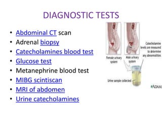 DIAGNOSTIC TESTS
•   Abdominal CT scan
•   Adrenal biopsy
•   Catecholamines blood test
•   Glucose test
•   Metanephrine blood test
•   MIBG scintiscan
•   MRI of abdomen
•   Urine catecholamines
 