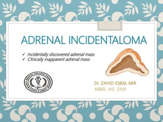 ADRENAL INCIDENTALOMA
Dr. ZAHID IQBAL MIR
MBBS, MS, DNB
 Incidentally discovered adrenal mass
 Clinically inapparent adrenal mass
 