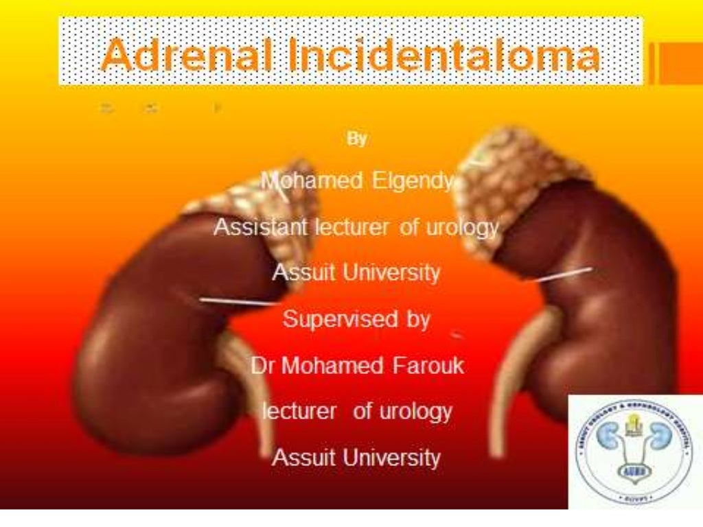 Adrenal incidentaloma
