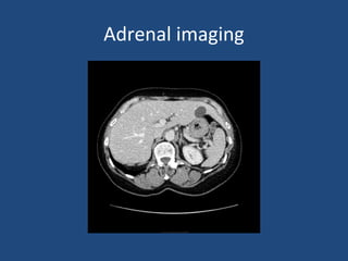 Adrenal imaging

 