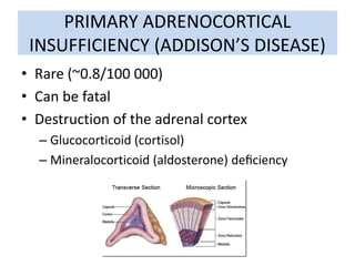 PRIMARY ADRENOCORTICAL
INSUFFICIENCY (ADDISON’S DISEASE)
• Rare (~0.8/100 000)
• Can be fatal
• Destruction of the adrenal cortex
– Glucocorticoid (cortisol)
– Mineralocorticoid (aldosterone) deﬁciency
 