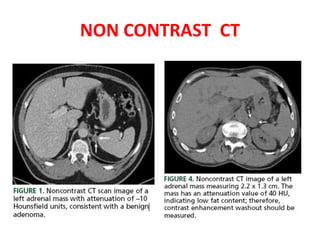 NON CONTRAST CT
 