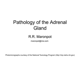 Pathology of the Adrenal
Gland
R.R. Maronpot
maronpot@me.com
Photomicrographs courtesy of the National Toxicology Program (http://ntp.niehs.nih.gov)
 