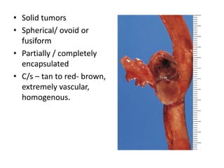 Adrenal Pathology | PPTX