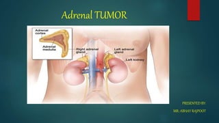 Adrenal TUMOR
PRESENTED BY:
MR: ABHAY RAJPOOT
 