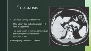 z
DIAGNOSIS
 Late night salivary cortisol levels
 24 hr urinary free cortisol excretion - >3
times of upper limit
 Non suppression of morning cortisol levels
after overnight dexamethasone
suppression test
Radiologically – Adrenal CT or MRI
 