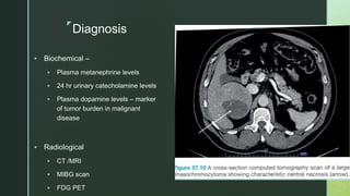 z
Diagnosis
 Biochemical –
 Plasma metanephrine levels
 24 hr urinary catecholamine levels
 Plasma dopamine levels – marker
of tumor burden in malignant
disease
 Radiological
 CT /MRI
 MIBG scan
 FDG PET
 