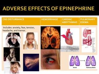 CNS DISTURBANCE
Includes: anxiety, fear, tension,
headache, and tremor.

HEMORRHAGE

CARDIAC
ARRYTHMIAS

PULMONARY
EDEMA

 