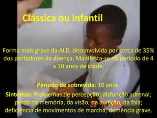 Clássica ou infantilForma mais grave da ALD, desenvolvida por cerca de 35% dos portadores da doença. Manifesta-se no período de 4 a 10 anos de idade.Período de sobrevida: 10 anos.Sintomas: Problemas de percepção; disfunção adrenal; perda da memória, da visão, da audição, da fala; deficiência de movimentos de marcha; demência grave.